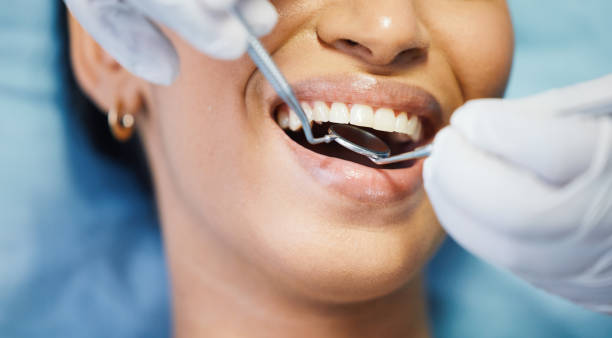 Best Emergency Dental Care for Broken or Chipped Teeth in Alexandria, LA