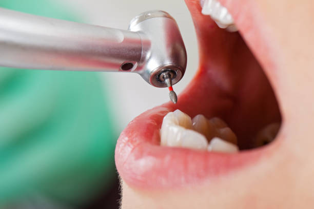 Best 24-Hour Emergency Dentist in Alexandria, LA